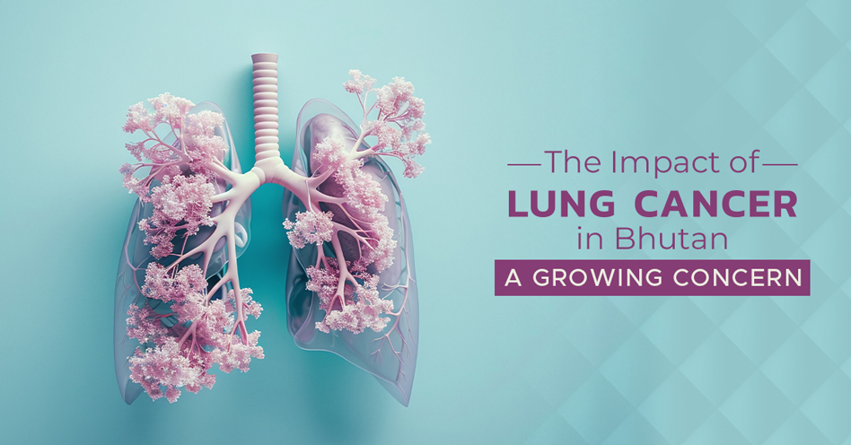 The Impact of Lung Cancer in Bhutan: A Growing Concern